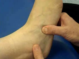 Repeated Ankle Sprains can be successfully treated by Foot Surgery Services